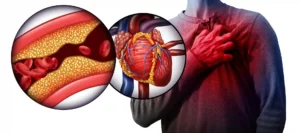 Heart attack risks while dancing