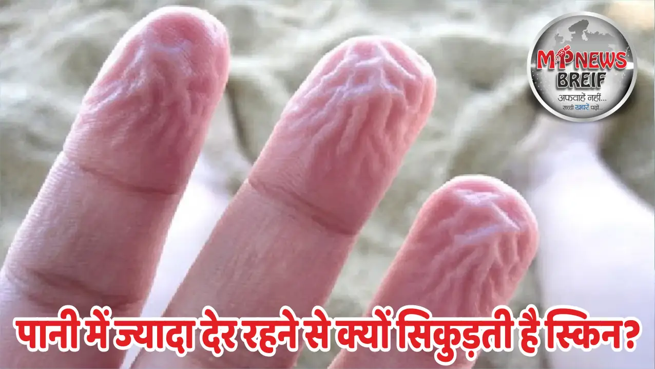 Why Does Skin Prune in Water? Causes and Prevention
