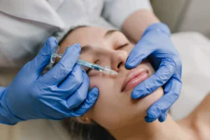 Modern lip enhancement with fillers