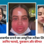 Modern lip enhancement with fillers