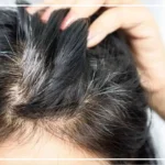 How to reverse gray hair caused by stress
