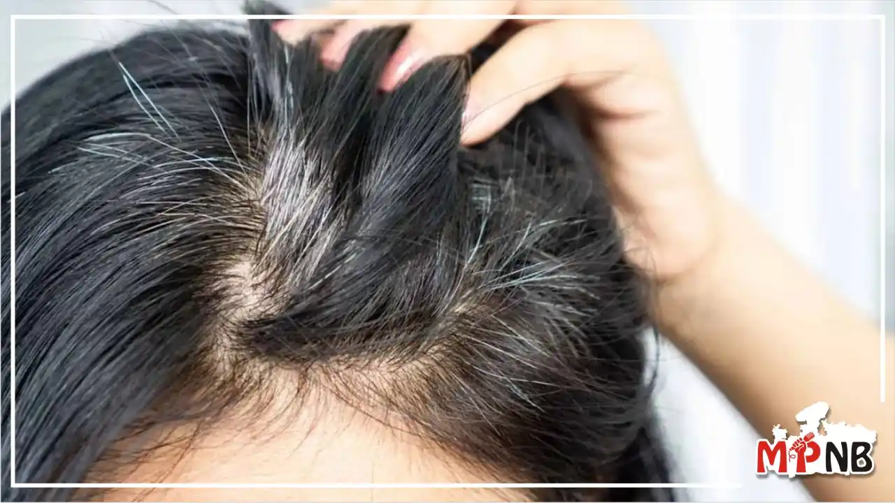 How to reverse gray hair caused by stress